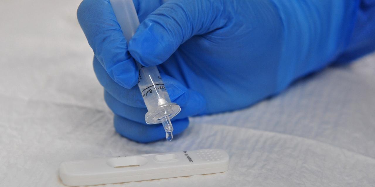 A Agência Nacional de Vigilância Sanitária (Anvisa) aprovou nesta quarta-feira o segundo autoteste para Covid-19 do país. O registro do produto foi publicado no Diário Oficial da União (DOU) e, agora, a […]