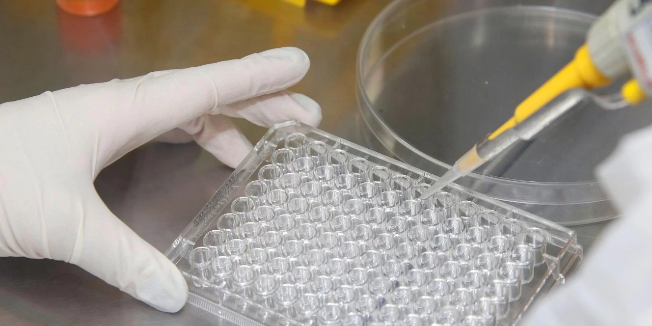 Casos, distribuídos por 17 estados, são de pessoas entre 3 meses e 16 anos O Ministério da Saúde investiga 88 casos da hepatite misteriosa, distribuídos por 17 estados brasileiros. De […]