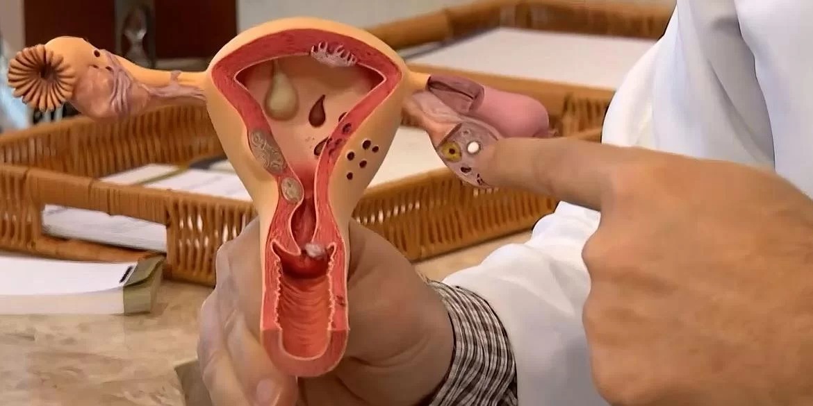 O estudo Um Olhar sobre o Diagnóstico do Câncer do Colo do Útero no Brasil, feito pela Fundação do Câncer, verificou que 21,4% das mulheres que fazem o exame citopatológico [&hellip;]