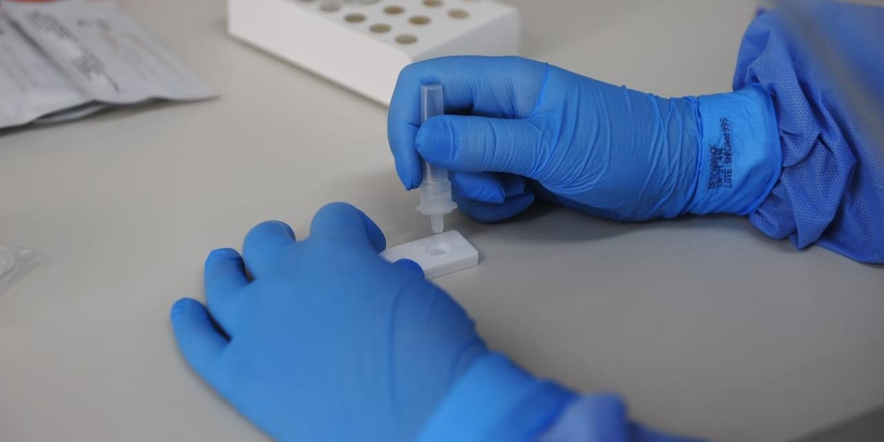 Os casos de Covid-19 detectados em todo o mundo aumentaram 80% no último mês, embora a mortalidade tenha reduzido 57%, conforme dados da Organização Mundial da Saúde (OMS) publicados nesta [&hellip;]