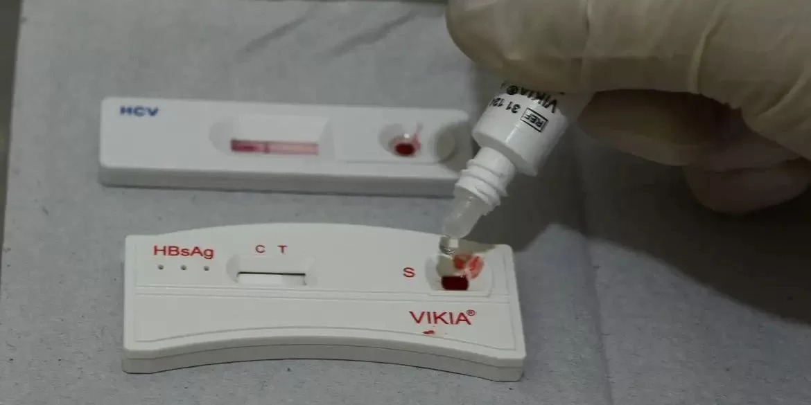 O Ministério da Saúde publicou o Boletim Epidemiológico que analisa a situação das cidades,&nbsp;estados e regiões do Brasil, em relação às infecções pelo vírus HIV. No dia Mundial de Prevenção [&hellip;]